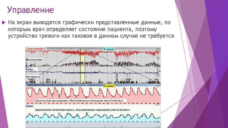 Управление На экран выводятся графически представленные данные, по которым врач определяет состояние пациента, поэтому