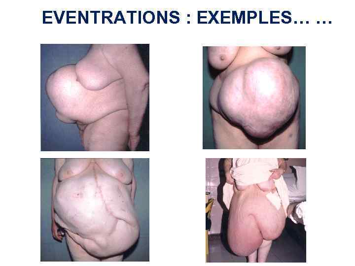 EVENTRATIONS : EXEMPLES… … 
