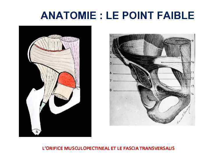 ANATOMIE : LE POINT FAIBLE L’ORIFICE MUSCULOPECTINEAL ET LE FASCIA TRANSVERSALIS 