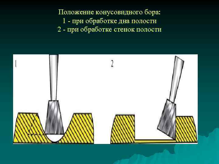 Положение конусовидного бора: 1 - при обработке дна полости 2 - при обработке стенок