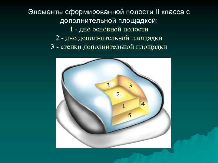 Элементы сформированной полости II класса с дополнительной площадкой: 1 - дно основной полости 2