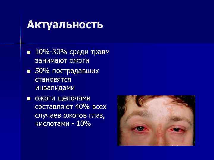 Актуальность n n n 10%-30% среди травм занимают ожоги 50% пострадавших становятся инвалидами ожоги