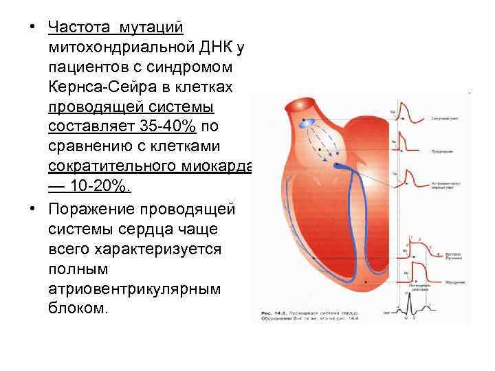  • Частота мутаций митохондриальной ДНК у пациентов с синдромом Кернса-Сейра в клетках проводящей