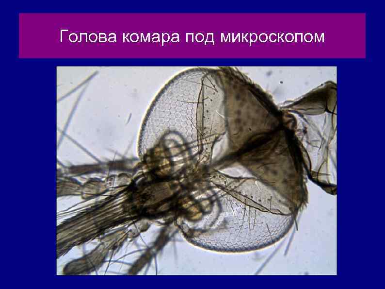Голова комара под микроскопом 
