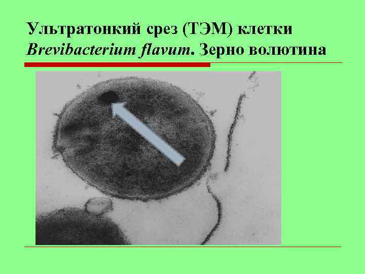 Ультратонкий срез (ТЭМ) клетки Brevibacterium flavum. Зерно волютина 