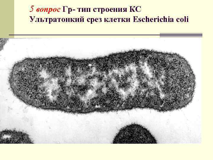 5 вопрос Гр- тип строения КС Ультратонкий срез клетки Escherichia coli 
