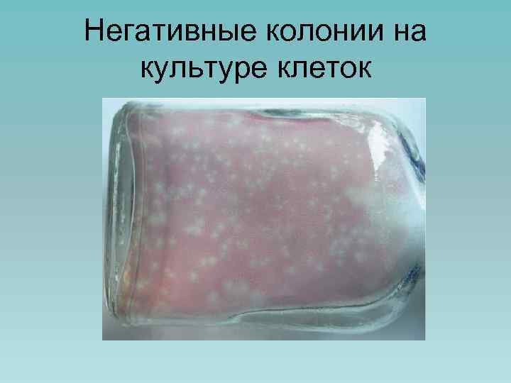 Негативные колонии на культуре клеток 