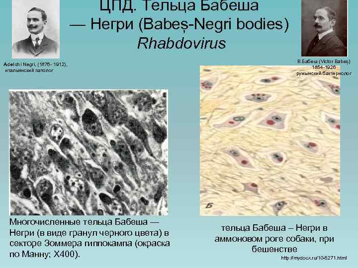 ЦПД. Тельца Бабеша — Негри (Babeș-Negri bodies) Rhabdovirus Adelchi Negri, (1876 - 1912), итальянский