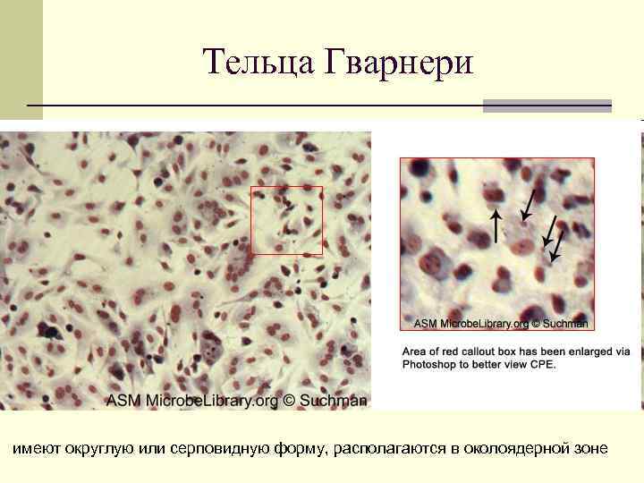 Тельца Гварнери имеют округлую или серповидную форму, располагаются в околоядерной зоне 