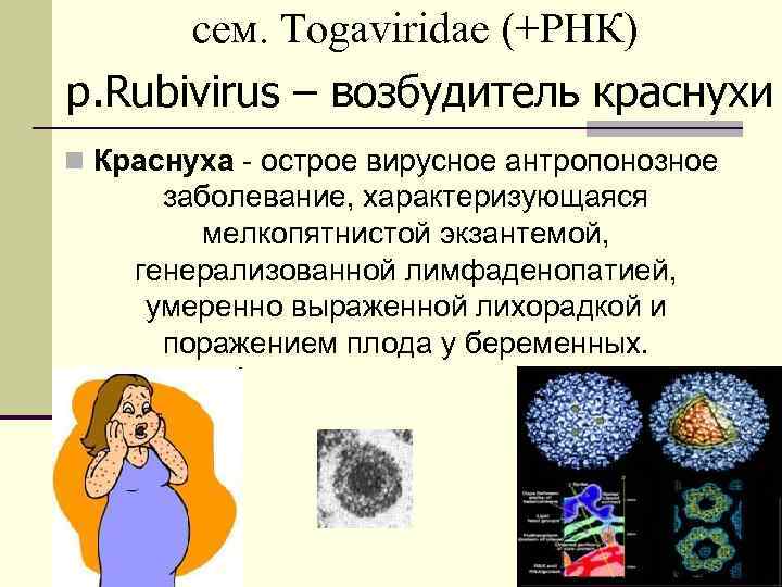 сем. Togaviridae (+РНК) р. Rubivirus – возбудитель краснухи n Краснуха - острое вирусное антропонозное