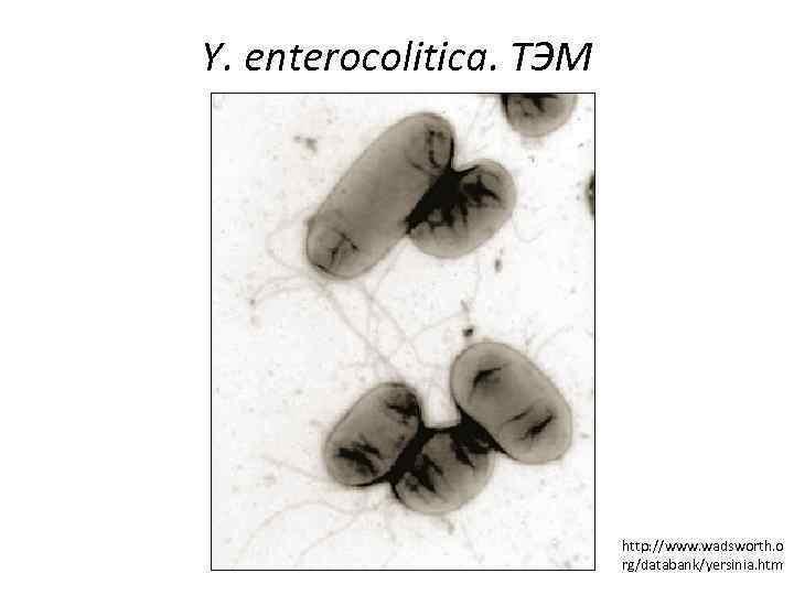 Y. еnterocolitica. ТЭМ http: //www. wadsworth. o rg/databank/yersinia. htm 