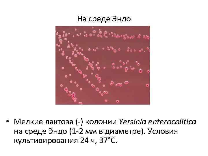 На среде Эндо • Мелкие лактоза (-) колонии Yersinia enterocolitica на среде Эндо (1