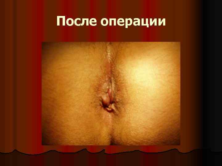 После операции 