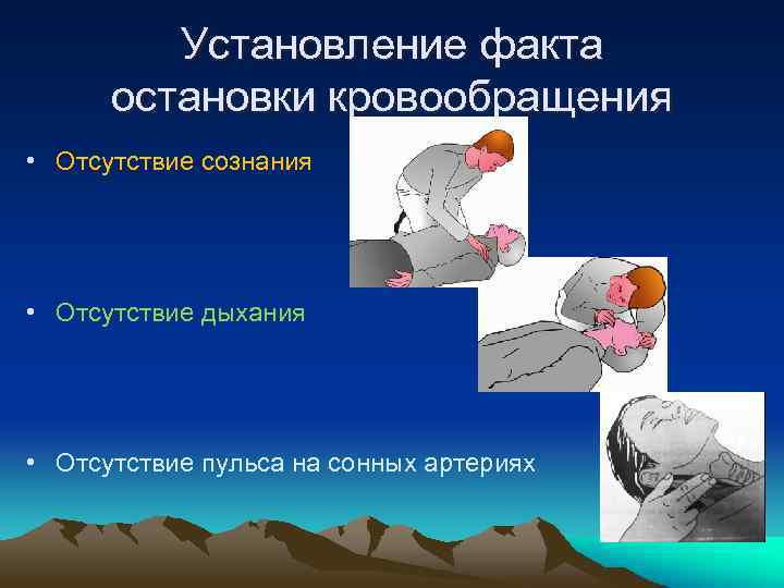 Установление факта остановки кровообращения • Отсутствие сознания • Отсутствие дыхания • Отсутствие пульса на