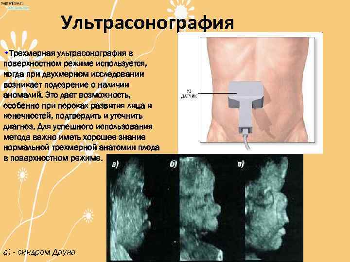 Поверхностный режим. Количественная ультрасонография. Ультрасонография это в генетике. Ультрасонография промежностная.