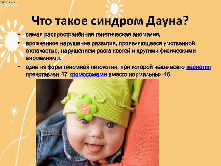 Что такое синдром Дауна? • самая распространённая генетическая аномалия. • врожденное нарушение развития, проявляющееся
