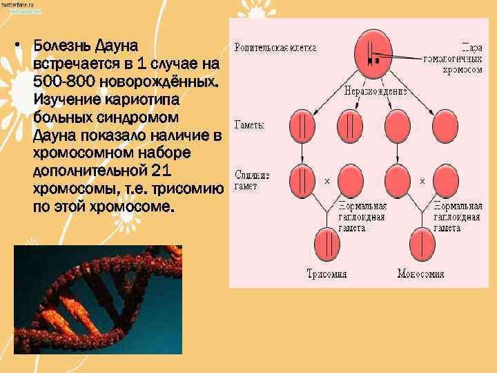  • Болезнь Дауна встречается в 1 случае на 500 -800 новорождённых. Изучение кариотипа