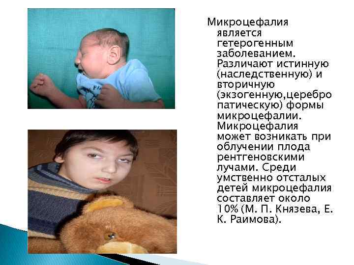 Микроцефалия является гетерогенным заболеванием. Различают истинную (наследственную) и вторичную (экзогенную, церебро патическую) формы микроцефалии.