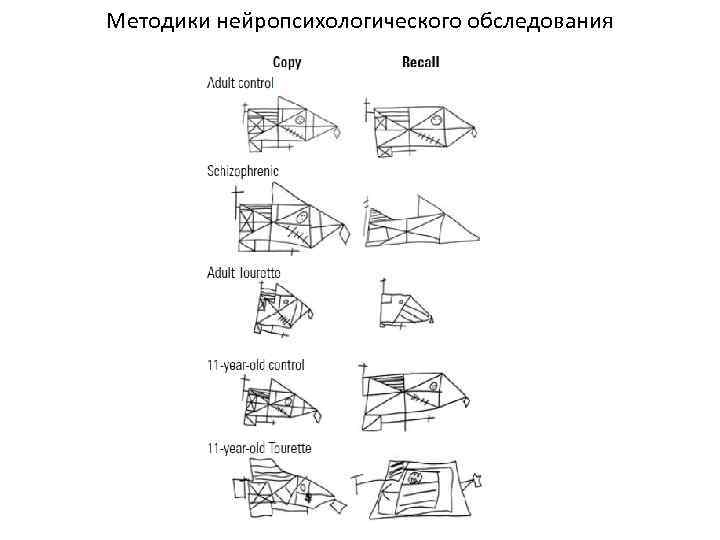 Методики нейропсихологического обследования 