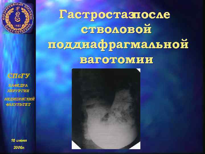 Гастростаз после стволовой поддиафрагмальной ваготомии СПб. ГУ КАФЕДРА ХИРУРГИИ МЕДИЦИНСКИЙ ФАКУЛЬТЕТ 16 июня 2006