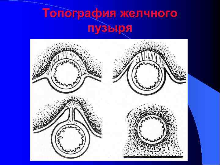 Топография желчного пузыря 