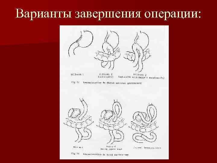 Варианты завершения операции: 