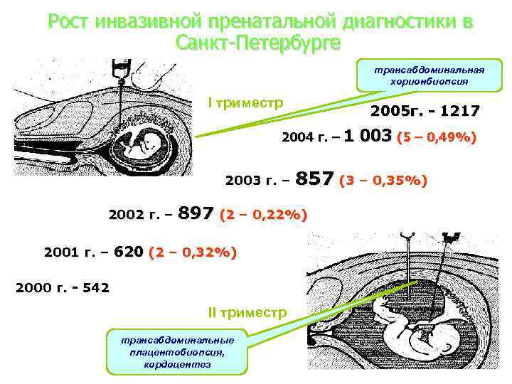 Рост инвазивной пренатальной диагностики в Санкт-Петербурге трансабдоминальная хорионбиопсия I триместр 2005 г. - 1217