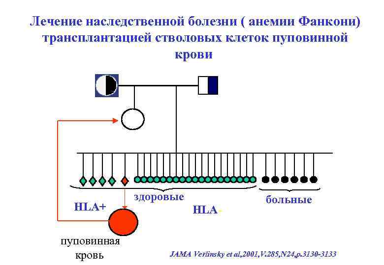 Лечение наследственной болезни ( анемии Фанкони) трансплантацией стволовых клеток пуповинной крови HLA+ пуповинная кровь