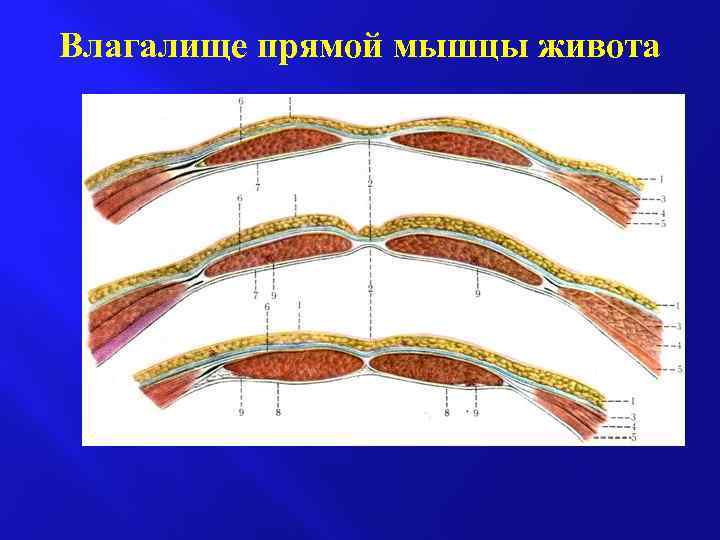 Влагалище прямой мышцы живота 
