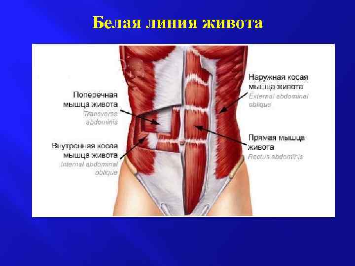 Белая линия живота 