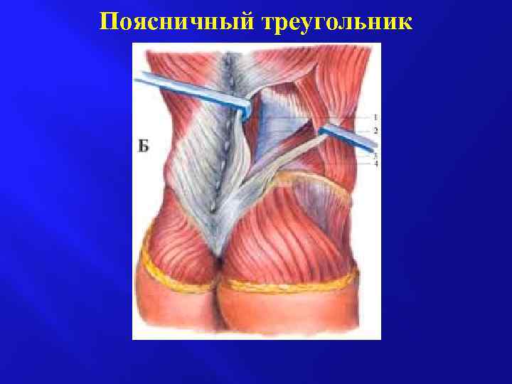 Поясничный треугольник 