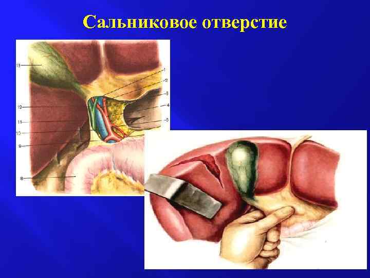 Сальниковое отверстие 