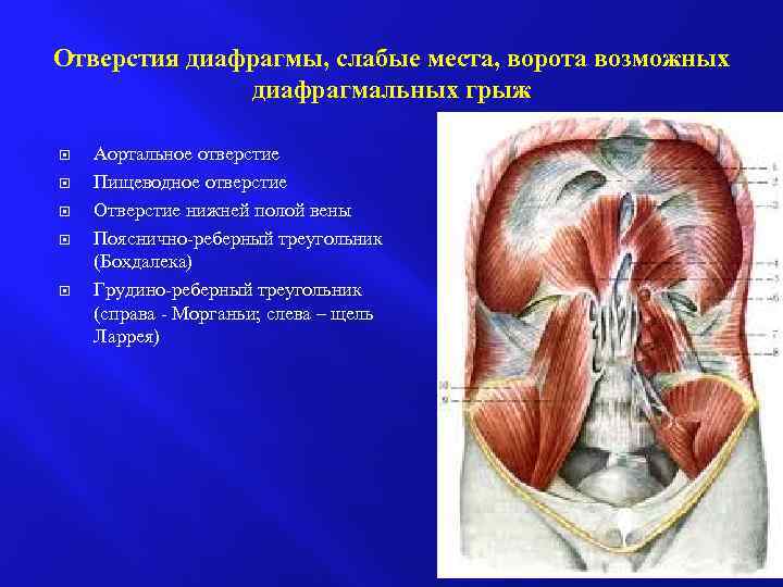 Отверстия диафрагмы, слабые места, ворота возможных диафрагмальных грыж Аортальное отверстие Пищеводное отверстие Отверстие нижней
