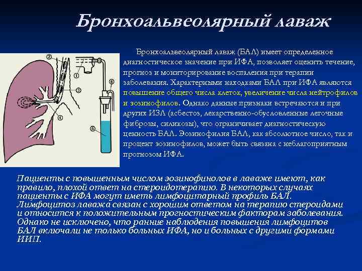 Бронхоальвеолярный лаваж (БАЛ) имеет определенное диагностическое значение при ИФА, позволяет оценить течение, прогноз и