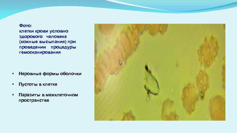 Фото: клетки крови условно здорового человека (кожные высыпания) при проведении процедуры гемосканирования • Неровные