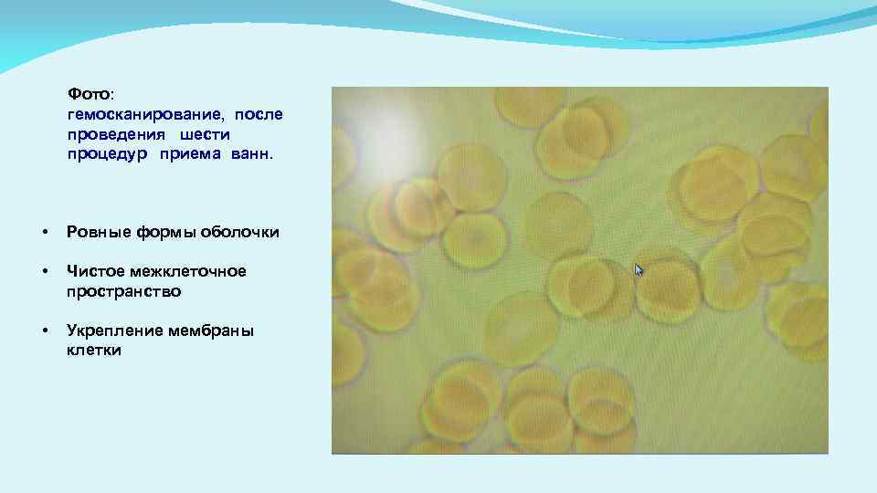 Фото: гемосканирование, после проведения шести процедур приема ванн. • Ровные формы оболочки • Чистое