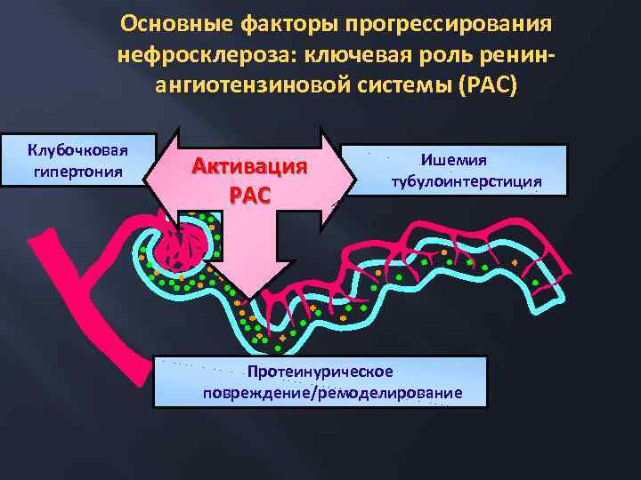 Основные факторы прогрессирования нефросклероза: ключевая роль ренинангиотензиновой системы (РАС) Клубочковая гипертония Активация РАС Ишемия