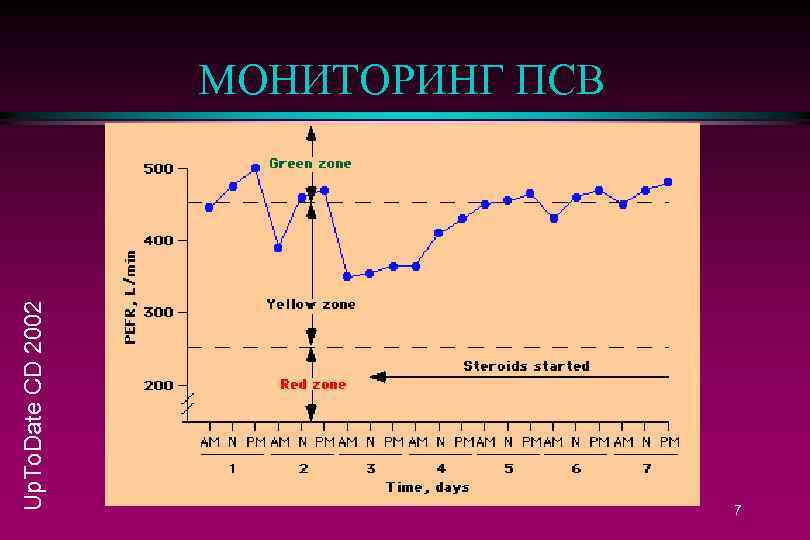 Up. To. Date CD 2002 МОНИТОРИНГ ПСВ 7 