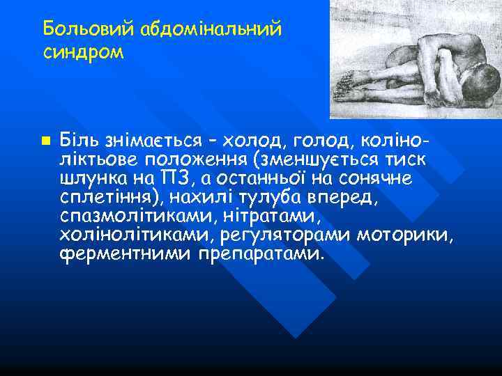 Больовий абдомінальний синдром n Біль знімається – холод, голод, коліноліктьове положення (зменшується тиск шлунка