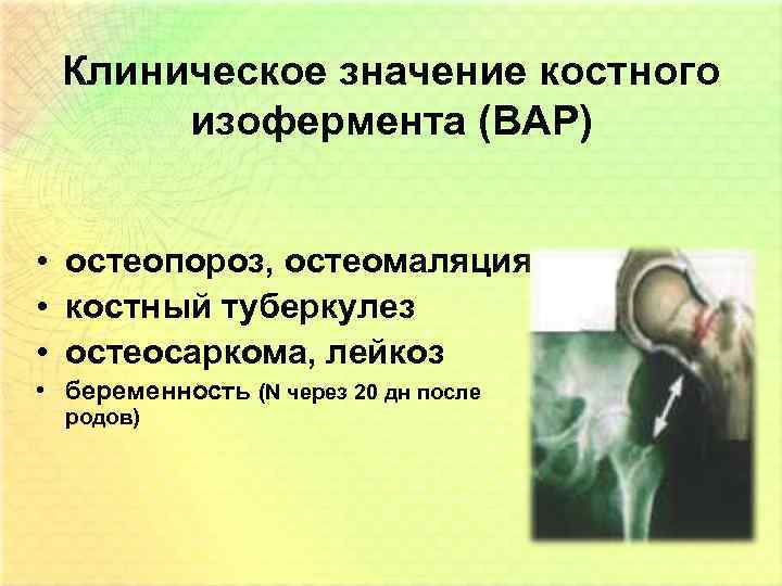 Клиническое значение костного изофермента (BAP) • остеопороз, остеомаляция • костный туберкулез • остеосаркома, лейкоз