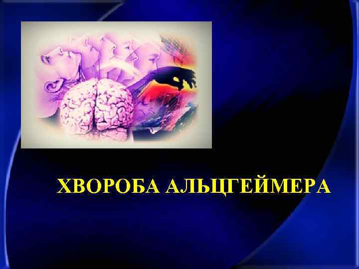 ХВОРОБА АЛЬЦГЕЙМЕРА 