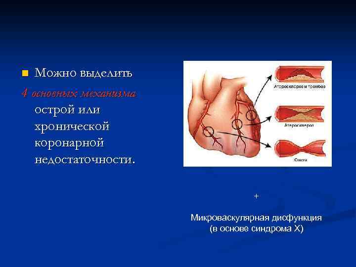 Можно выделить 4 основных механизма острой или хронической коронарной недостаточности. n + Микроваскулярная дисфункция