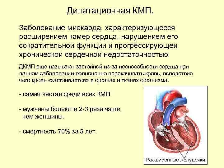 Дилатационная кардиомиопатия что это такое