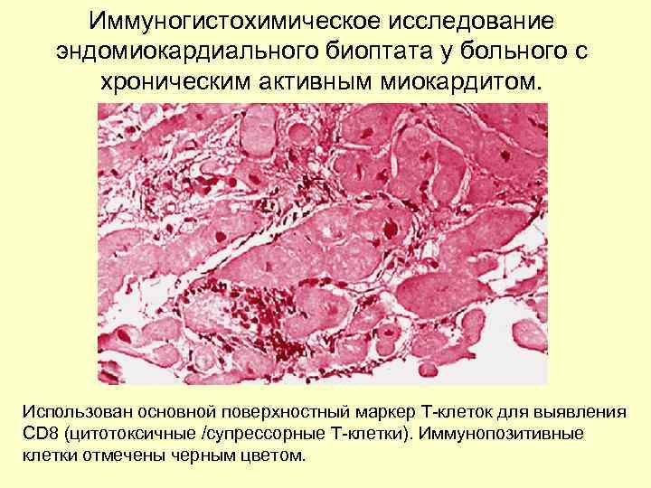 Иммуногистохимические методы исследования. Иммуногистохимический анализ. Иммуногистохимия (ИГХ).