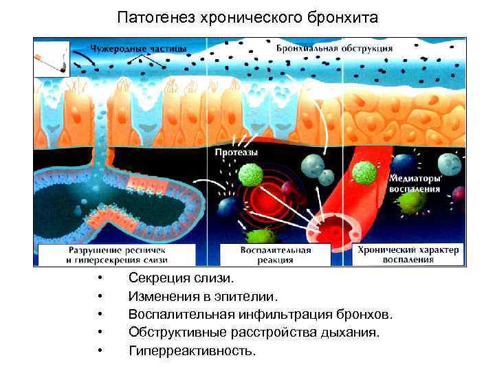 Патогенез хронического бронхита • • • Секреция слизи. Изменения в эпителии. Воспалительная инфильтрация бронхов.