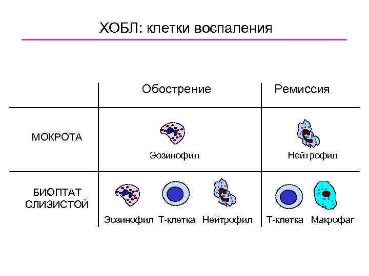 ХОБЛ: клетки воспаления Обострение Ремиссия МОКРОТА Эозинофил Нейтрофил БИОПТАТ СЛИЗИСТОЙ Эозинофил T-клетка Нейтрофил T-клетка