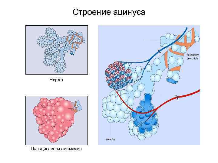 Схема строения ацинуса легкого