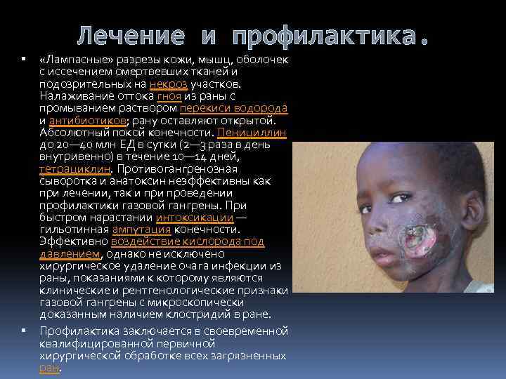  Лечение и профилактика. «Лампасные» разрезы кожи, мышц, оболочек с иссечением омертвевших тканей и