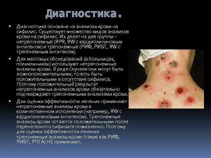Диагностика. Диагностика основана на анализах крови на сифилис. Существует множество видов анализов крови на