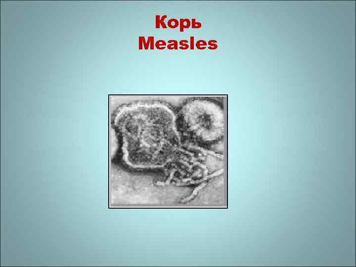 Корь Measles 